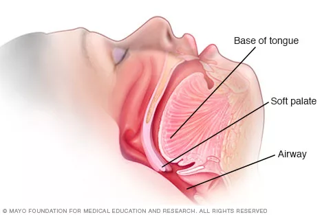 how to stop snoring effective tips and remedies 5 jpg