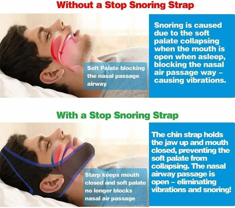 Snoring Chin Strap Snoring Chin Strap Comfortable Universal Anti Snoring Devices Adjustable Effective Stop Snoring Sleep Aid Snore Reducing Aid for Women  Men